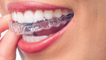 Tannréttingaskinnur